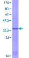 OTOP1 Protein - 12.5% SDS-PAGE Stained with Coomassie Blue.