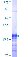 OTOP2 Protein - 12.5% SDS-PAGE Stained with Coomassie Blue.