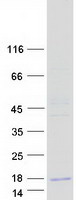 OTOR / Otoraplin Protein - Purified recombinant protein OTOR was analyzed by SDS-PAGE gel and Coomassie Blue Staining