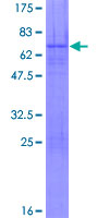 OTP Protein - 12.5% SDS-PAGE of human OTP stained with Coomassie Blue