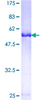 OTUB1 / OTU1 Protein - 12.5% SDS-PAGE of human OTUB1 stained with Coomassie Blue