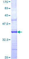 OTUB2 Protein - 12.5% SDS-PAGE Stained with Coomassie Blue.