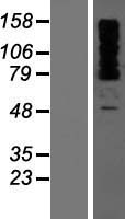 OTUD4 Protein - Western validation with an anti-DDK antibody * L: Control HEK293 lysate R: Over-expression lysate