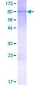 OTUD4 Protein - 12.5% SDS-PAGE of human OTUD4 stained with Coomassie Blue