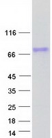 OTUD5 Protein - Purified recombinant protein OTUD5 was analyzed by SDS-PAGE gel and Coomassie Blue Staining