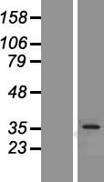 OTUD6B Protein - Western validation with an anti-DDK antibody * L: Control HEK293 lysate R: Over-expression lysate