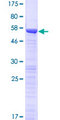 OTUD6B Protein - 12.5% SDS-PAGE of human OTUD6B stained with Coomassie Blue