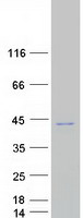 OTUD6B Protein - Purified recombinant protein OTUD6B was analyzed by SDS-PAGE gel and Coomassie Blue Staining