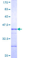 OTUD7A Protein - 12.5% SDS-PAGE Stained with Coomassie Blue.