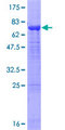 OTUD7B / Cezanne Protein - 12.5% SDS-PAGE of human ZA20D1 stained with Coomassie Blue