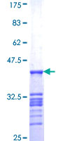 OTUD7B / Cezanne Protein - 12.5% SDS-PAGE Stained with Coomassie Blue.