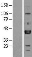 OTX1 Protein - Western validation with an anti-DDK antibody * L: Control HEK293 lysate R: Over-expression lysate