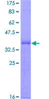 OTX1 Protein - 12.5% SDS-PAGE Stained with Coomassie Blue.