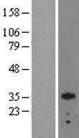 OTX2 Protein - Western validation with an anti-DDK antibody * L: Control HEK293 lysate R: Over-expression lysate