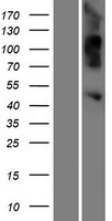 OVCA1 / DPH1 Protein - Western validation with an anti-DDK antibody * L: Control HEK293 lysate R: Over-expression lysate