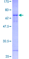 OVCA1 / DPH1 Protein - 12.5% SDS-PAGE of human DPH1 stained with Coomassie Blue