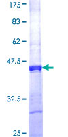 OVCA1 / DPH1 Protein - 12.5% SDS-PAGE Stained with Coomassie Blue.