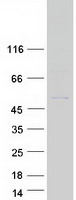 OVCA1 / DPH1 Protein - Purified recombinant protein DPH1 was analyzed by SDS-PAGE gel and Coomassie Blue Staining