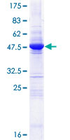 OVCA2 Protein - 12.5% SDS-PAGE of human OVCA2 stained with Coomassie Blue