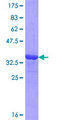 OVGP1 / Oviductin Protein - 12.5% SDS-PAGE Stained with Coomassie Blue.