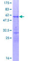 OVOL1 Protein - 12.5% SDS-PAGE of human OVOL1 stained with Coomassie Blue