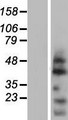 OVOL2 Protein - Western validation with an anti-DDK antibody * L: Control HEK293 lysate R: Over-expression lysate