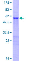 OVOL2 Protein - 12.5% SDS-PAGE of human OVOL2 stained with Coomassie Blue