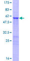 OVOL2 Protein - 12.5% SDS-PAGE of human OVOL2 stained with Coomassie Blue