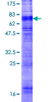 OX1R / Orexin Receptor 1 Protein - 12.5% SDS-PAGE of human HCRTR1 stained with Coomassie Blue