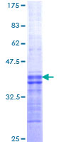 OX2R / Orexin Receptor 2 Protein - 12.5% SDS-PAGE Stained with Coomassie Blue.