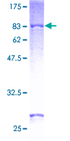 OXCT1 Protein - 12.5% SDS-PAGE of human OXCT1 stained with Coomassie Blue