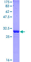 OXCT1 Protein - 12.5% SDS-PAGE Stained with Coomassie Blue.