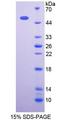 OXCT1 Protein - Recombinant  3-Oxoacid Coenzyme A Transferase 1 By SDS-PAGE