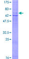 OXER1 Protein - 12.5% SDS-PAGE of human OXER1 stained with Coomassie Blue