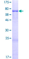OXSM / KS Protein - 12.5% SDS-PAGE of human OXSM stained with Coomassie Blue