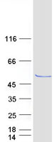 OXSM / KS Protein - Purified recombinant protein OXSM was analyzed by SDS-PAGE gel and Coomassie Blue Staining