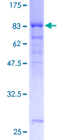 OXSR1 / OSR1 Protein - 12.5% SDS-PAGE of human OXSR1 stained with Coomassie Blue