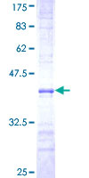 OXSR1 / OSR1 Protein - 12.5% SDS-PAGE Stained with Coomassie Blue.