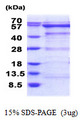 OXSR1 / OSR1 Protein