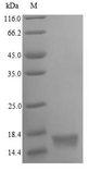 Oxytocin Protein - (Tris-Glycine gel) Discontinuous SDS-PAGE (reduced) with 5% enrichment gel and 15% separation gel.