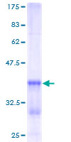 p16INK4a / CDKN2A Protein - 12.5% SDS-PAGE of human CDKN2A stained with Coomassie Blue