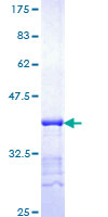 p16INK4a / CDKN2A Protein - 12.5% SDS-PAGE Stained with Coomassie Blue.