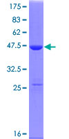 p21-ARC / ARPC3 Protein - 12.5% SDS-PAGE of human ARPC3 stained with Coomassie Blue