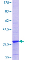 p21-ARC / ARPC3 Protein - 12.5% SDS-PAGE Stained with Coomassie Blue.