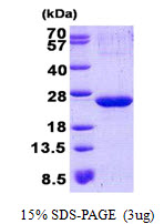 p21-ARC / ARPC3 Protein