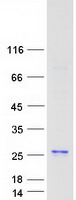 p21-ARC / ARPC3 Protein - Purified recombinant protein ARPC3 was analyzed by SDS-PAGE gel and Coomassie Blue Staining