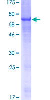 P2RX2 / P2X2 Protein - 12.5% SDS-PAGE of human P2RX2 stained with Coomassie Blue