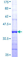 P2RX3 / P2X3 Protein - 12.5% SDS-PAGE Stained with Coomassie Blue.