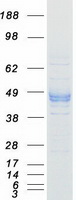 P2RX3 / P2X3 Protein - Purified recombinant protein P2RX3 was analyzed by SDS-PAGE gel and Coomassie Blue Staining