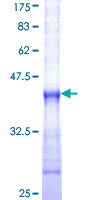 P2RX5 / P2X5 Protein - 12.5% SDS-PAGE Stained with Coomassie Blue